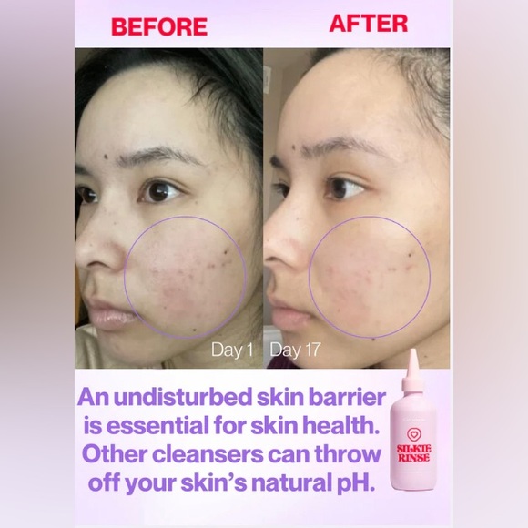 Kiramoon Silkie Cleanser Non-Drying + Removes Makeup - Picture 2 of 11